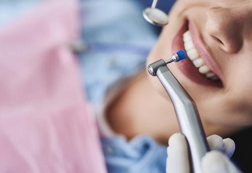 close up of woman getting dental cleaning