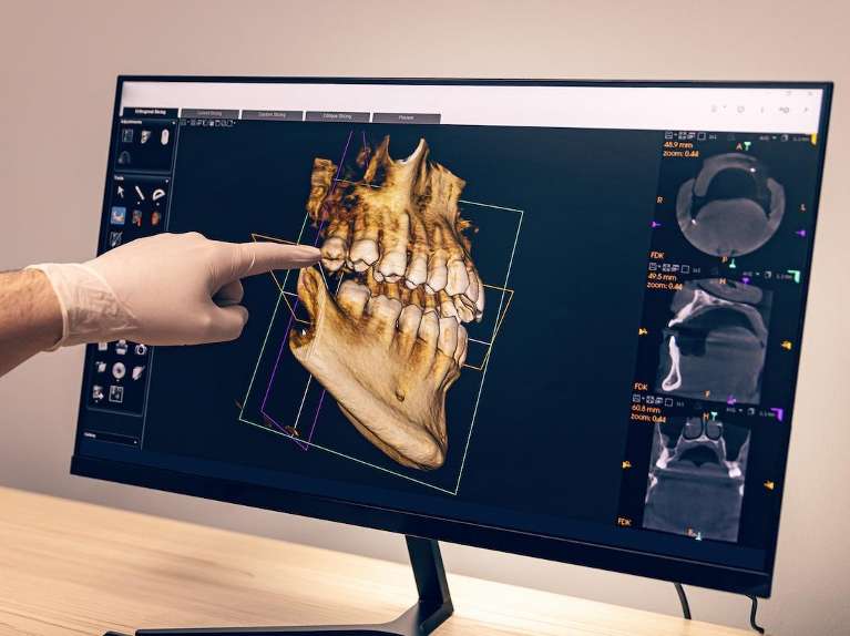 3-D Cone Beam Imaging (CBCT)
